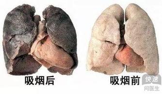 肺癌晚期的人吃茄瓜